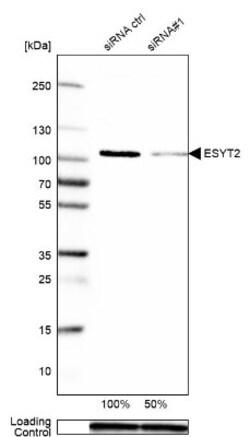 FAM62B Antibody, Novus Biologicals 25 &mu;L; Unlabeled:Antibodies, Polyclonal